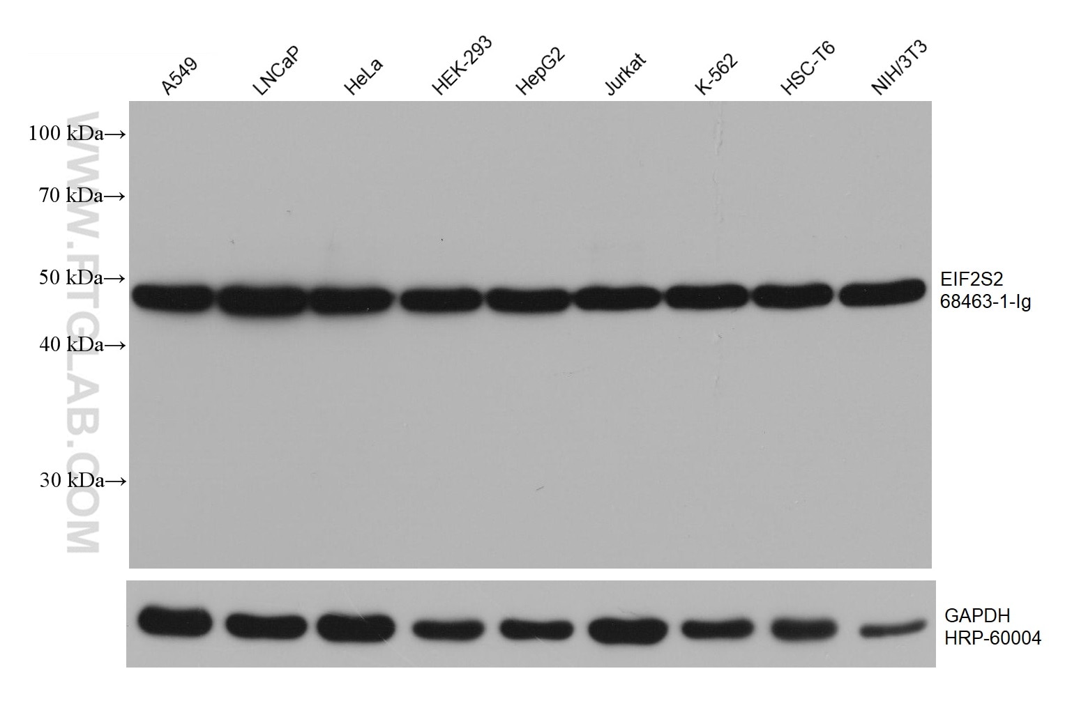 WB analysis using 68463-1-Ig