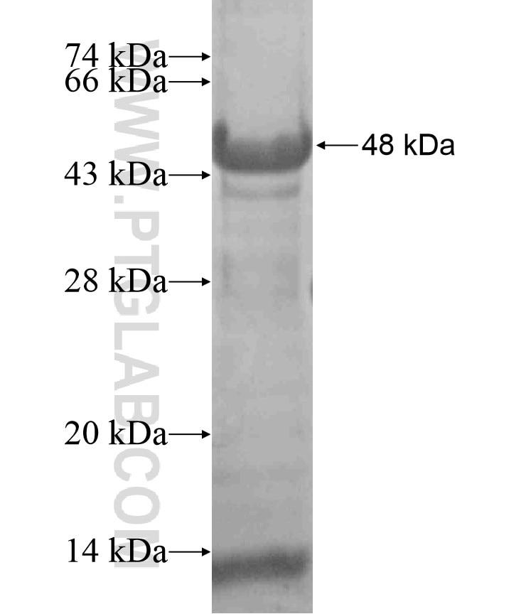 EIF2S2 fusion protein Ag18349 SDS-PAGE