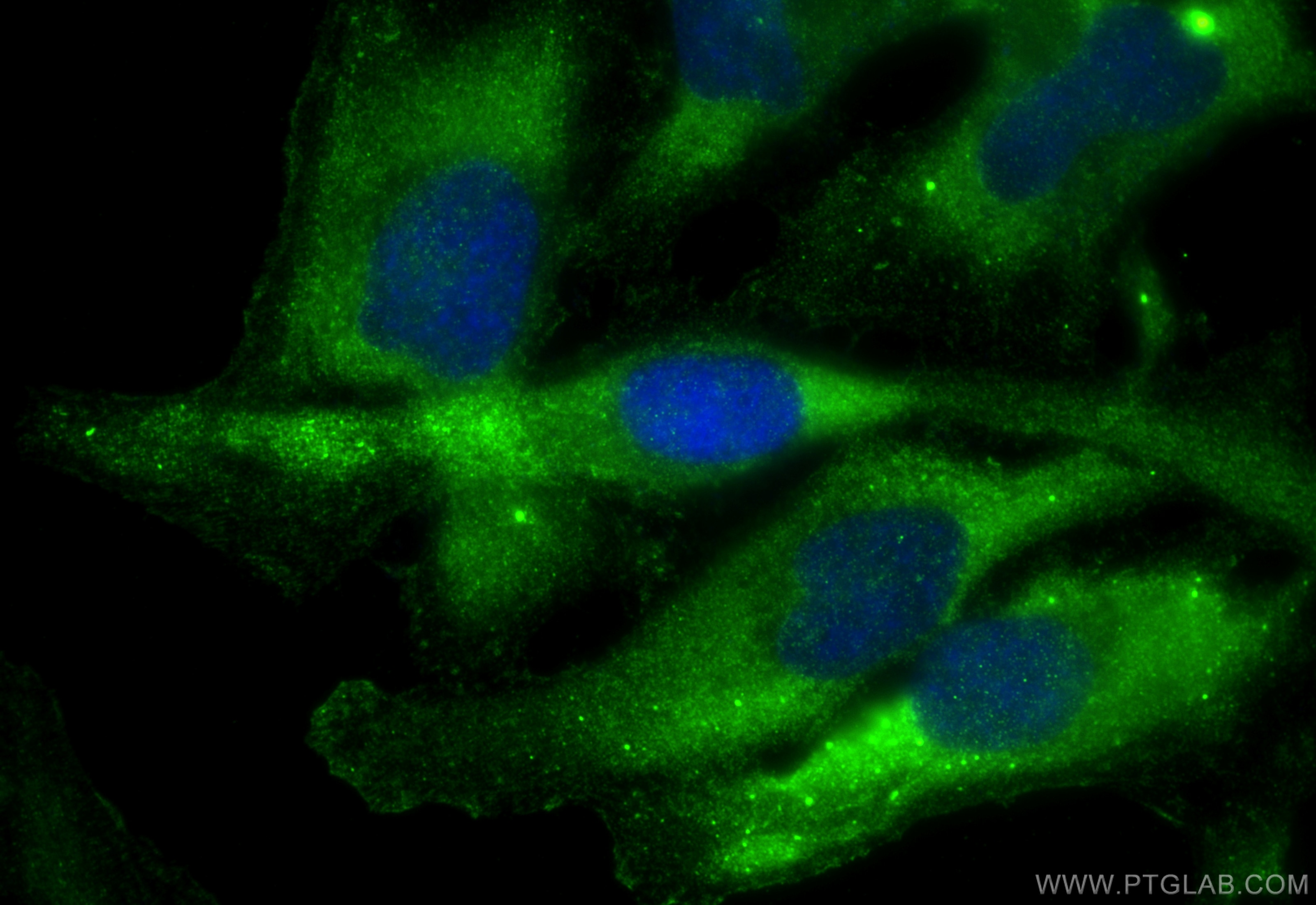 Immunofluorescence (IF) / fluorescent staining of HeLa cells using EIF2S3 Polyclonal antibody (11162-1-AP)