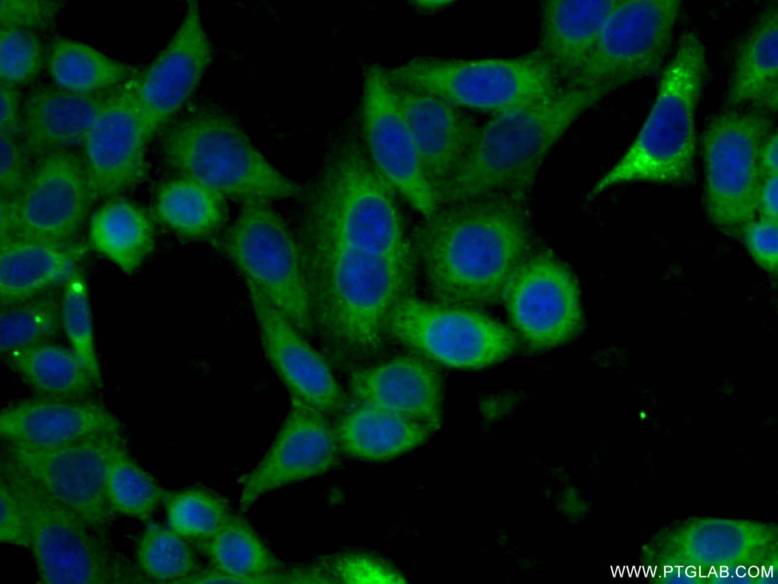 Immunofluorescence (IF) / fluorescent staining of HeLa cells using EIF2S3 Polyclonal antibody (11162-1-AP)