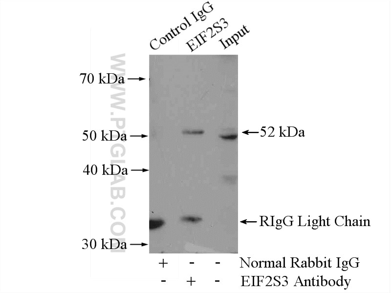 Immunoprecipitation (IP) experiment of HeLa cells using EIF2S3 Polyclonal antibody (11162-1-AP)
