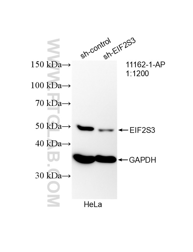 WB analysis of HeLa using 11162-1-AP Western Blot (WB) analysis of HeLa cells using EIF2S3 Polyclonal antibody (11162-1-AP)