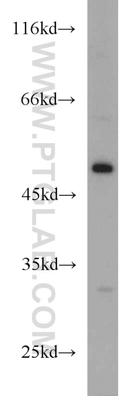 Western Blot (WB) analysis of HeLa cells using EIF2S3 Polyclonal antibody (11162-1-AP)