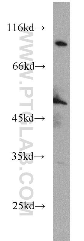 Western Blot (WB) analysis of COLO 320 cells using EIF2S3 Polyclonal antibody (11162-1-AP)