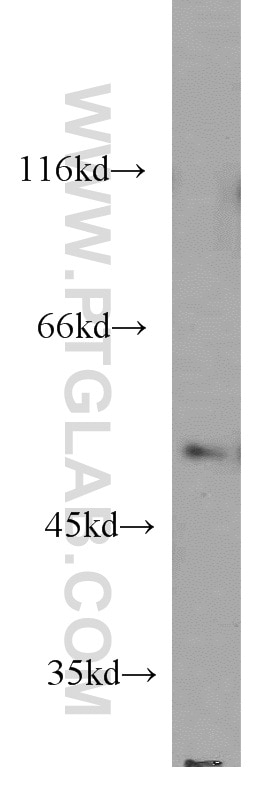 Western Blot (WB) analysis of HeLa cells using EIF2S3 Polyclonal antibody (11162-1-AP)