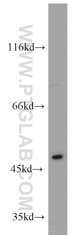 Western Blot (WB) analysis of mouse thymus tissue using EIF2S3 Polyclonal antibody (11162-1-AP)