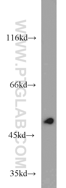 Western Blot (WB) analysis of mouse thymus tissue using EIF2S3 Polyclonal antibody (11162-1-AP)