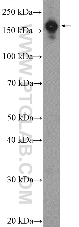 Western Blot (WB) analysis of HEK-293 cells using EIF3A Polyclonal antibody (26178-1-AP)