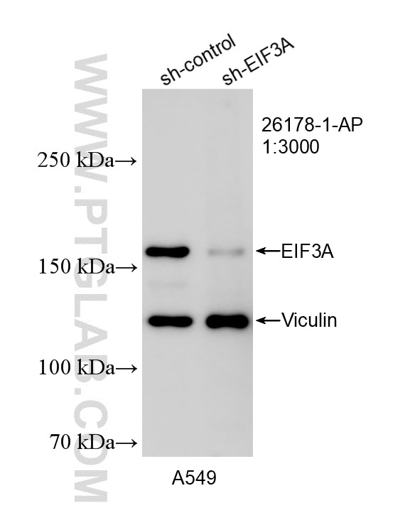 WB result of EIF3A antibody (26178-1-AP; 1:3000; incubated at room temperature for 1.5 hours) with sh-Control and sh-EIF3A transfected A549 cells. Western Blot (WB) analysis of A549 cells using EIF3A Polyclonal antibody (26178-1-AP)
