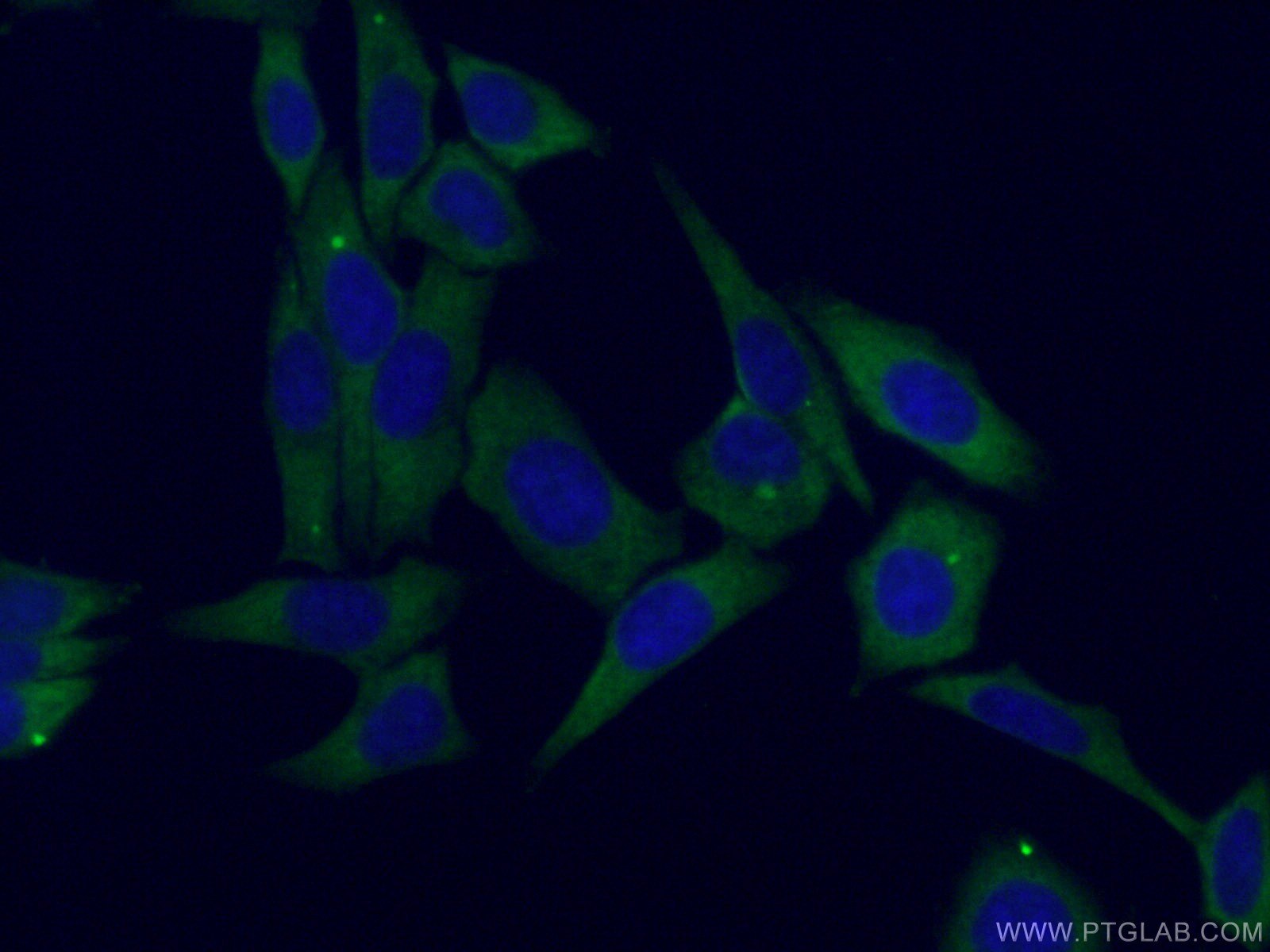 IF Staining of HepG2 using 27665-1-AP