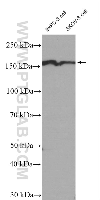 Western Blot (WB) analysis of BxPC-3 cells using EIF3A Polyclonal antibody (27665-1-AP)