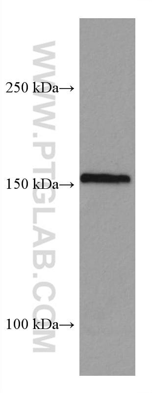 WB analysis of K-562 using 67713-1-Ig