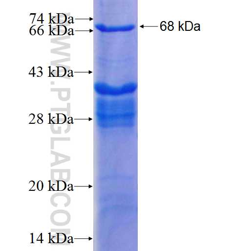 EIF3A fusion protein Ag22515 SDS-PAGE