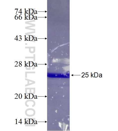 EIF3A fusion protein Ag24762 SDS-PAGE