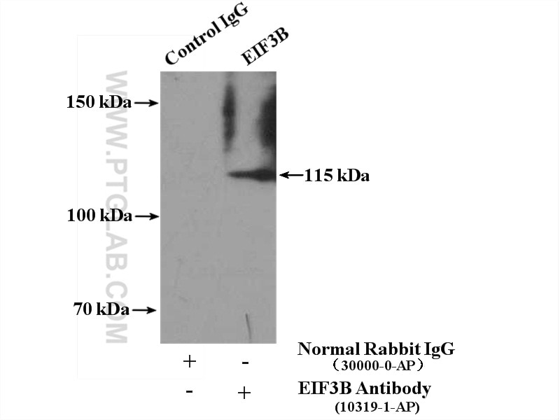 Immunoprecipitation (IP) experiment of A375 cells using EIF3B Polyclonal antibody (10319-1-AP)