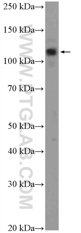 Western Blot (WB) analysis of A375 cells using EIF3B Polyclonal antibody (10319-1-AP)