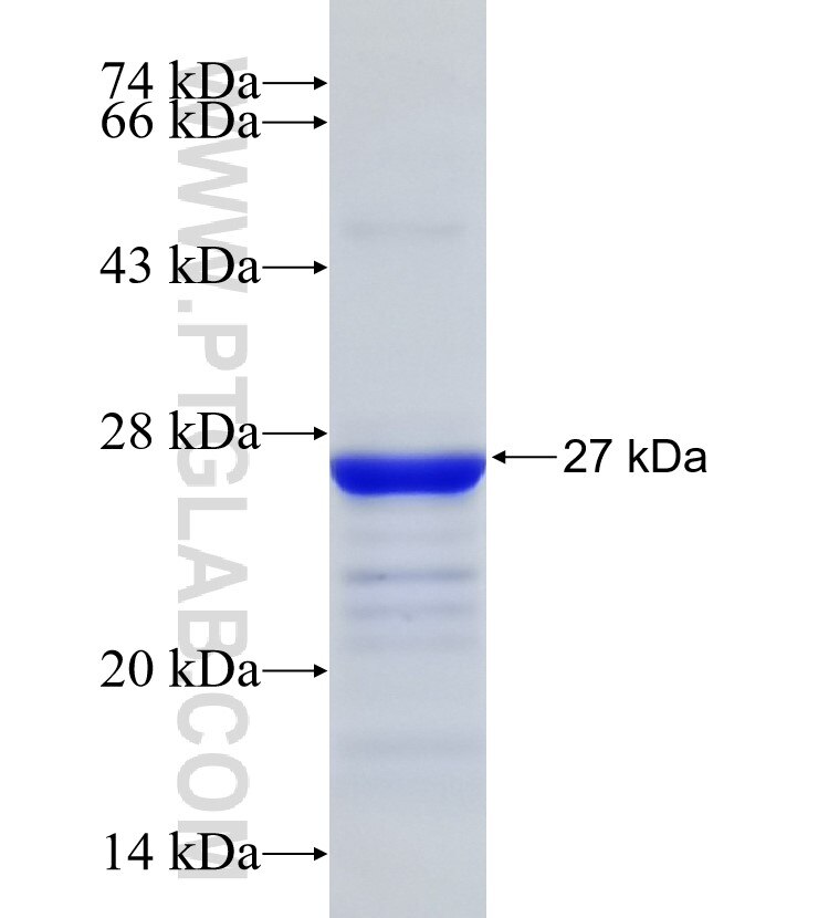 EIF3B fusion protein Ag31427 SDS-PAGE