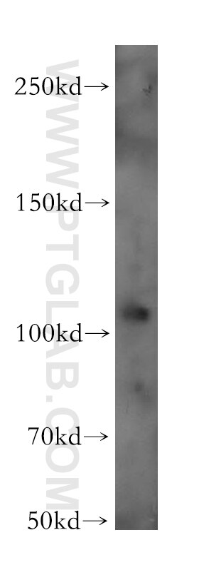 Western Blot (WB) analysis of MCF-7 cells using EIF3C Polyclonal antibody (12733-1-AP)