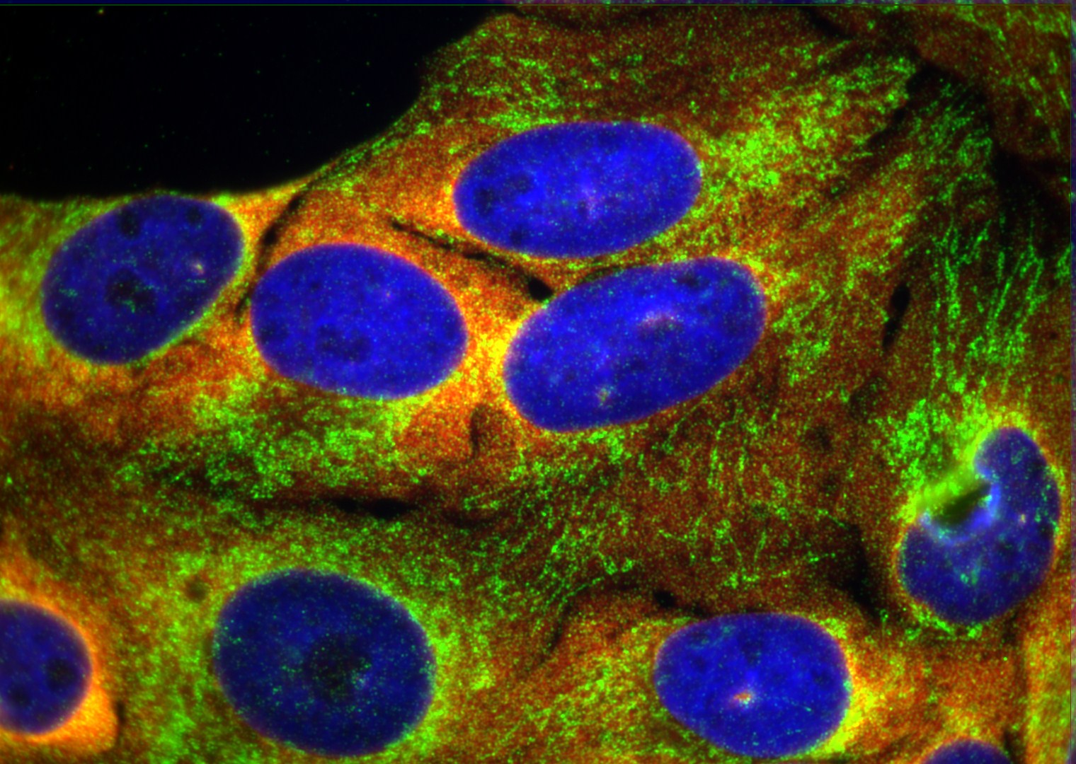 Immunofluorescence (IF) / fluorescent staining of transfected cells using EIF3D Polyclonal antibody (10219-1-AP)