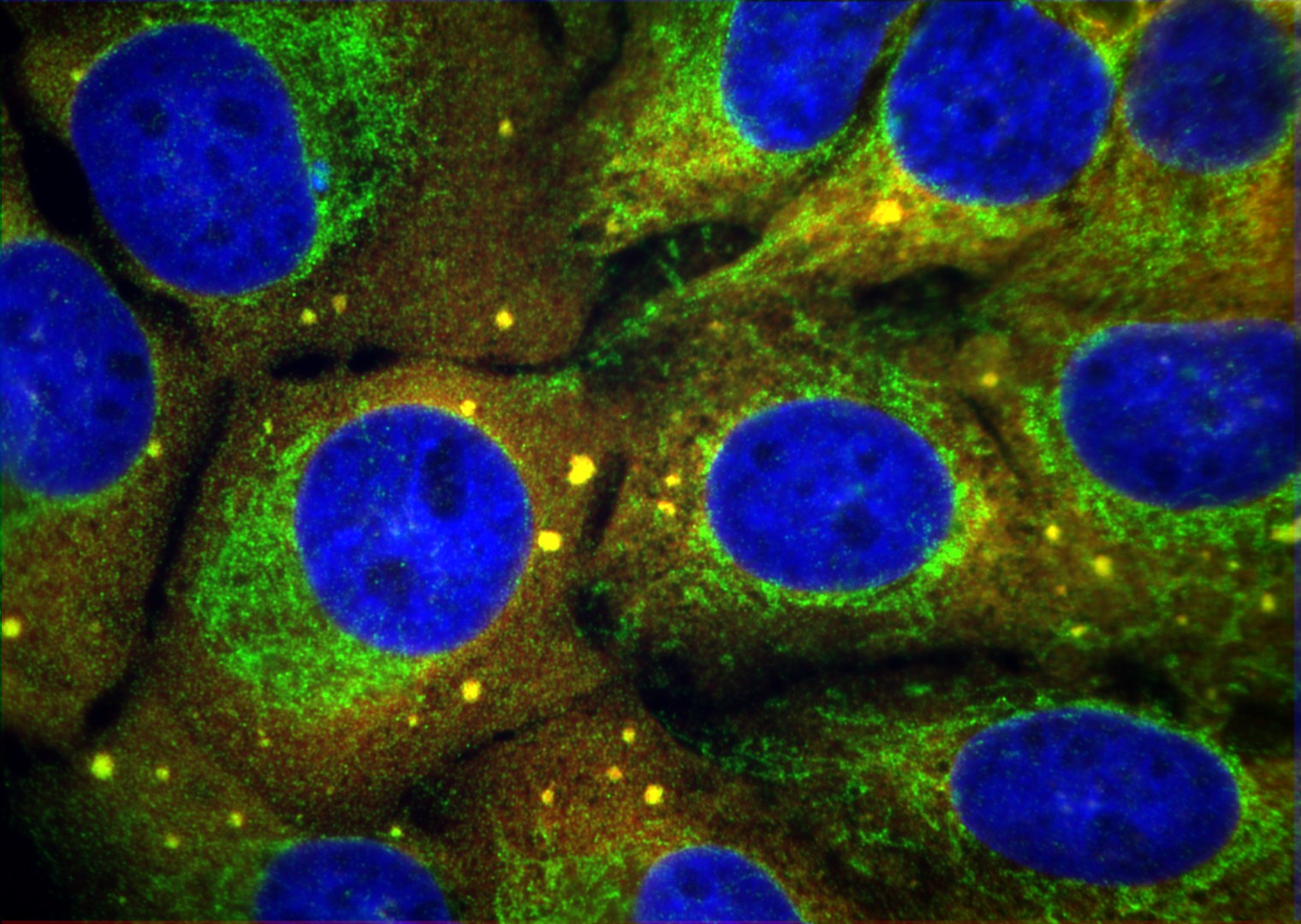 Immunofluorescence (IF) / fluorescent staining using EIF3D Polyclonal antibody (10219-1-AP)