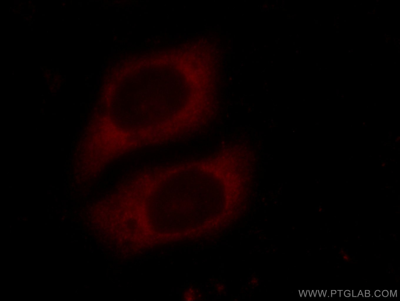 IF Staining of HepG2 using 10219-1-AP