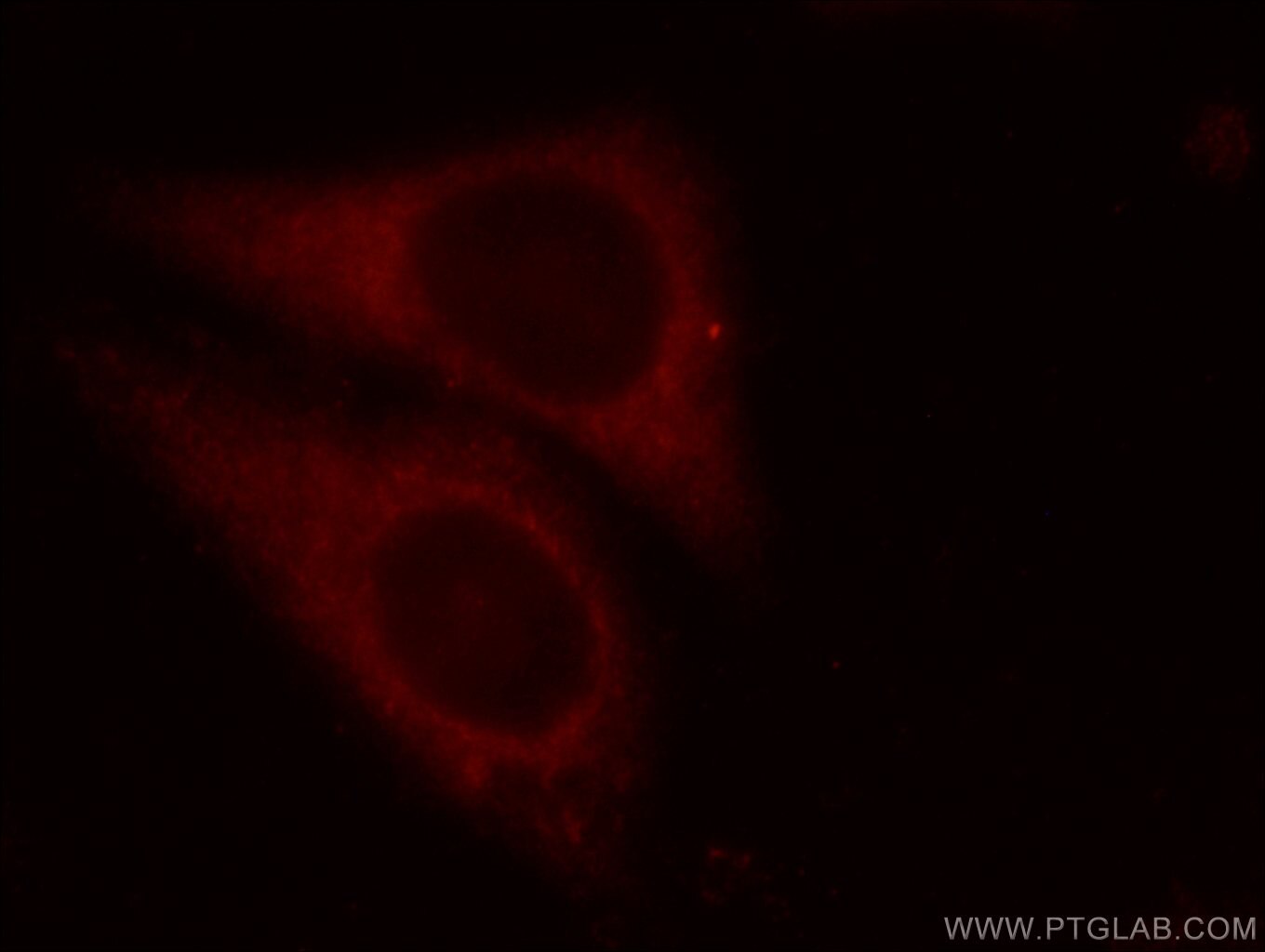 Immunofluorescence (IF) / fluorescent staining of HepG2 cells using EIF3D Polyclonal antibody (10219-1-AP)