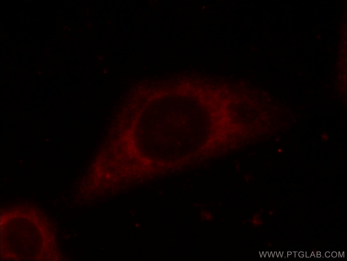 Immunofluorescence (IF) / fluorescent staining of HepG2 cells using EIF3D Polyclonal antibody (10219-1-AP)