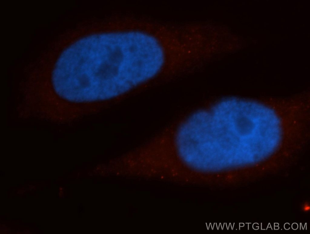 IF Staining of MCF-7 using 10219-1-AP