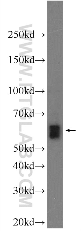 Western Blot (WB) analysis of A549 cells using EIF3D Polyclonal antibody (10219-1-AP)