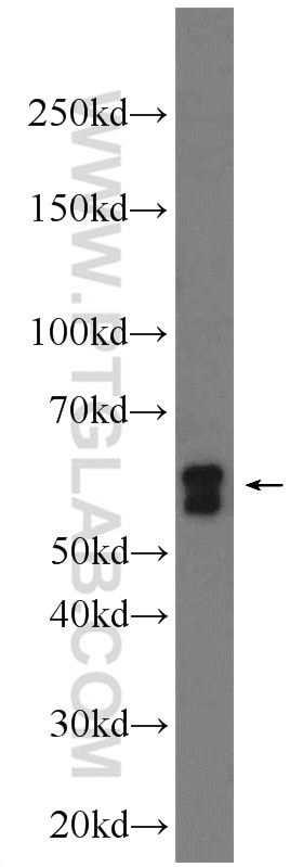 Western Blot (WB) analysis of HepG2 cells using EIF3D Polyclonal antibody (10219-1-AP)