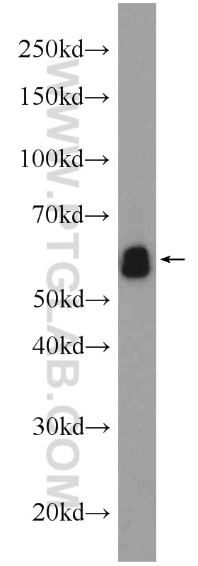 Western Blot (WB) analysis of mouse brain tissue using EIF3D Polyclonal antibody (10219-1-AP)