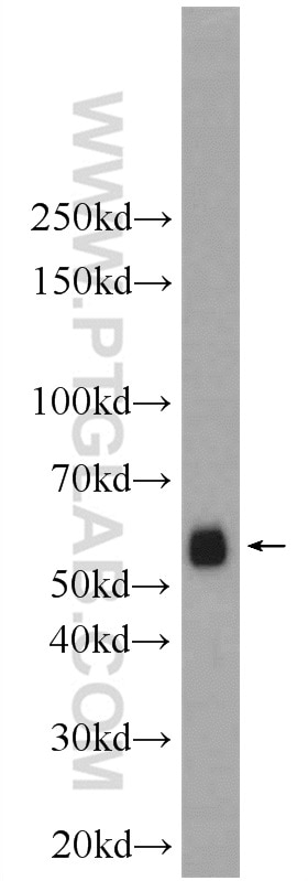 Western Blot (WB) analysis of human brain tissue using EIF3D Polyclonal antibody (10219-1-AP)