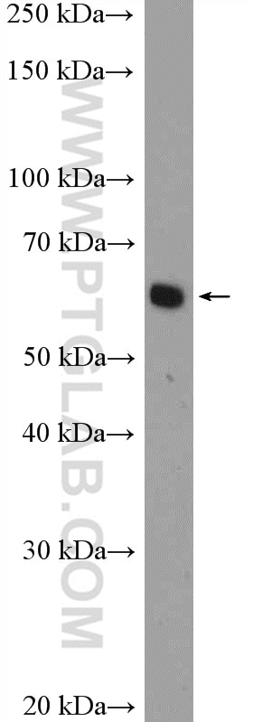 Western Blot (WB) analysis of L02 cells using EIF3D Polyclonal antibody (10219-1-AP)