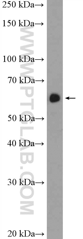 Western Blot (WB) analysis of L02 cells using EIF3D Polyclonal antibody (10219-1-AP)