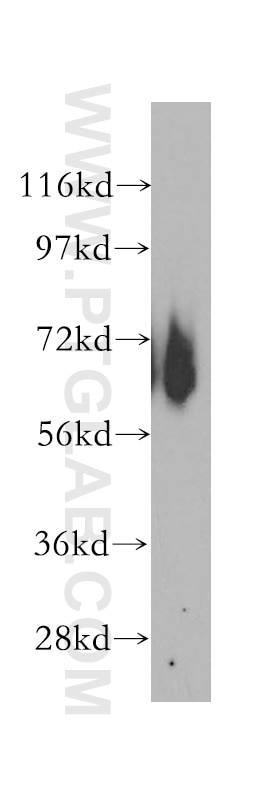 Western Blot (WB) analysis of mouse brain tissue using EIF3D Polyclonal antibody (10219-1-AP)