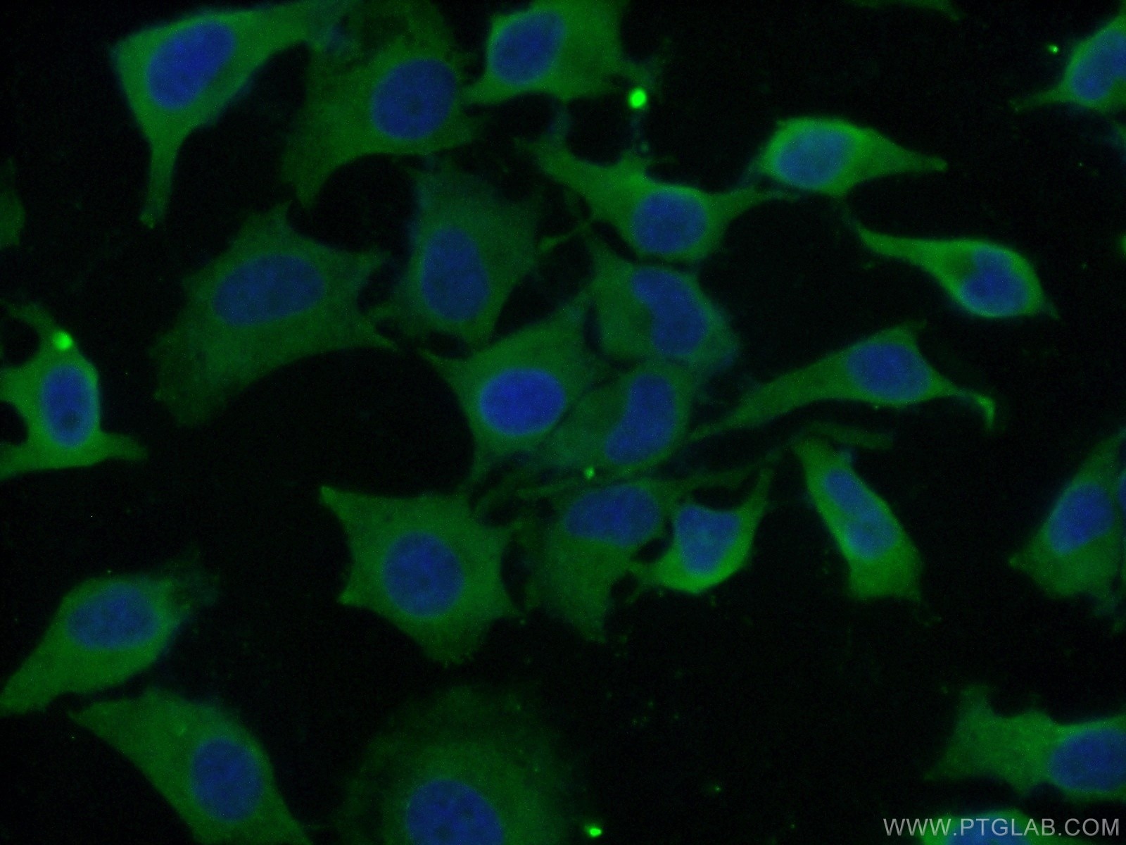 Immunofluorescence (IF) / fluorescent staining of HeLa cells using EIF3D Monoclonal antibody (66024-1-Ig)