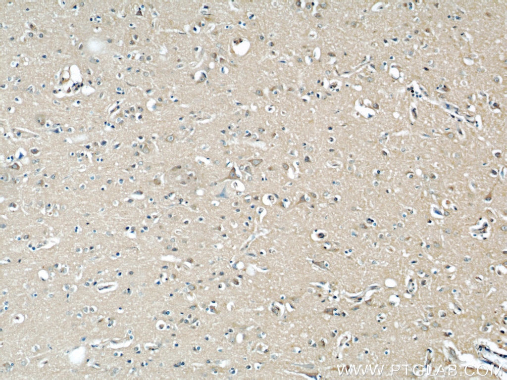 Immunohistochemistry (IHC) staining of human brain tissue using EIF3D Monoclonal antibody (66024-1-Ig)