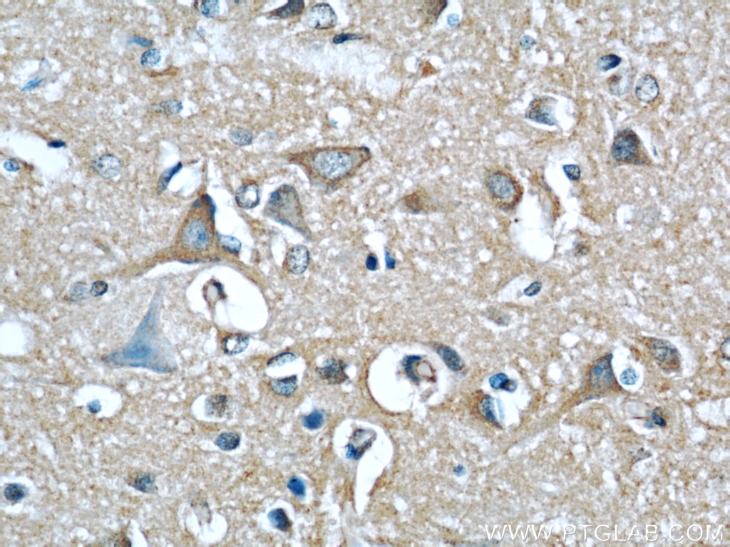 IHC staining of human brain using 66024-1-Ig