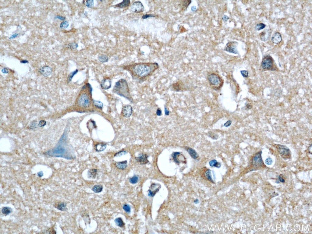 Immunohistochemistry (IHC) staining of human brain tissue using EIF3D Monoclonal antibody (66024-1-Ig)