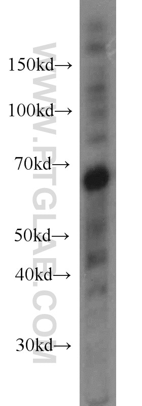 Western Blot (WB) analysis of human brain tissue using EIF3D Monoclonal antibody (66024-1-Ig)