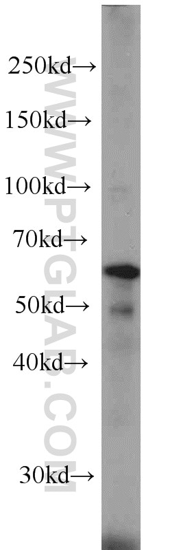 Western Blot (WB) analysis of HeLa cells using EIF3D Monoclonal antibody (66024-1-Ig)