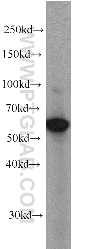 Western Blot (WB) analysis of A431 cells using EIF3D Monoclonal antibody (66024-1-Ig)