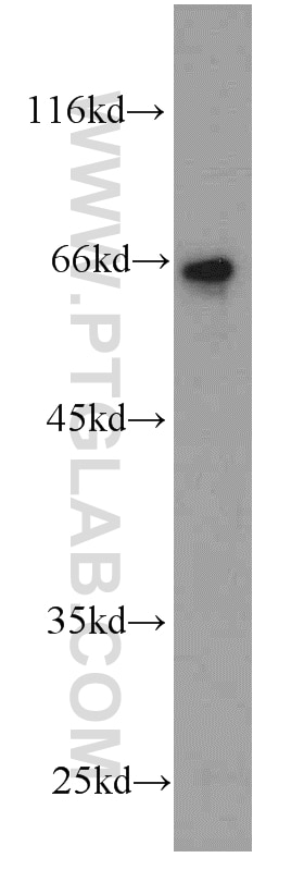 Western Blot (WB) analysis of HeLa cells using EIF3D Monoclonal antibody (66024-1-Ig)