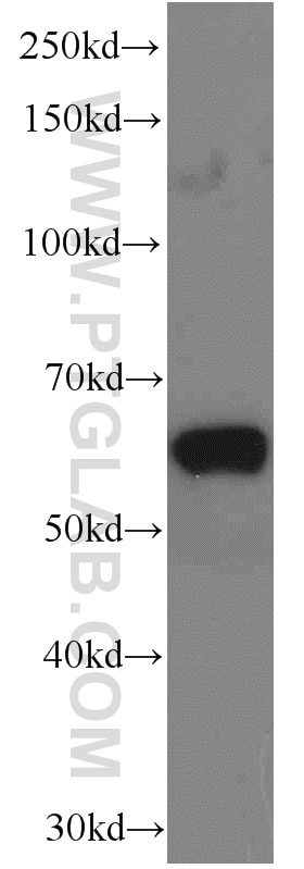 Western Blot (WB) analysis of HepG2 cells using EIF3D Monoclonal antibody (66024-1-Ig)