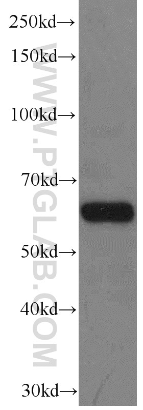 Western Blot (WB) analysis of mouse liver tissue using EIF3D Monoclonal antibody (66024-1-Ig)
