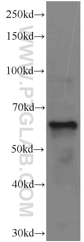 Western Blot (WB) analysis of rat liver tissue using EIF3D Monoclonal antibody (66024-1-Ig)