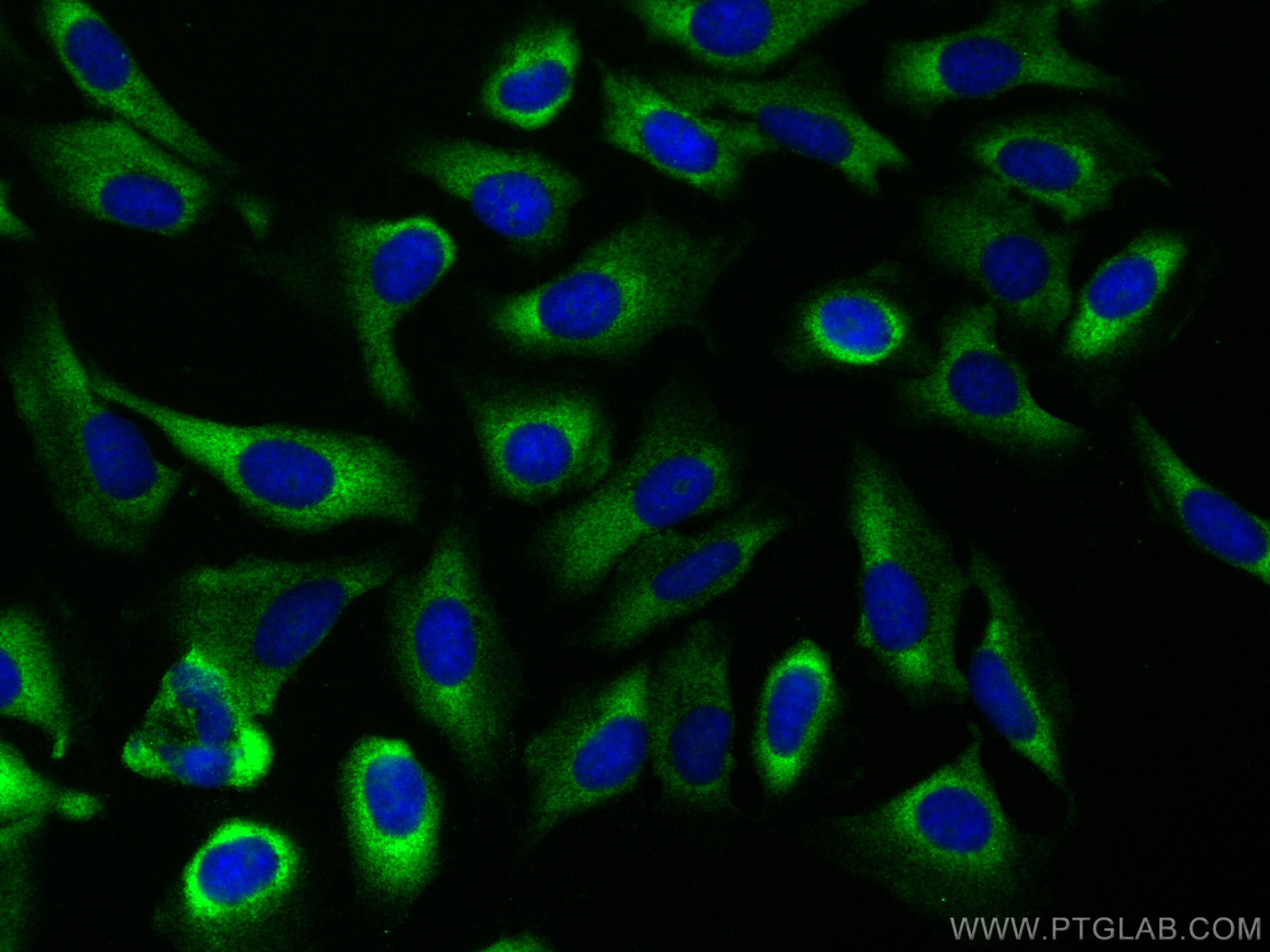 Immunofluorescence (IF) / fluorescent staining of U2OS cells using EIF3D Recombinant antibody (82512-1-RR)