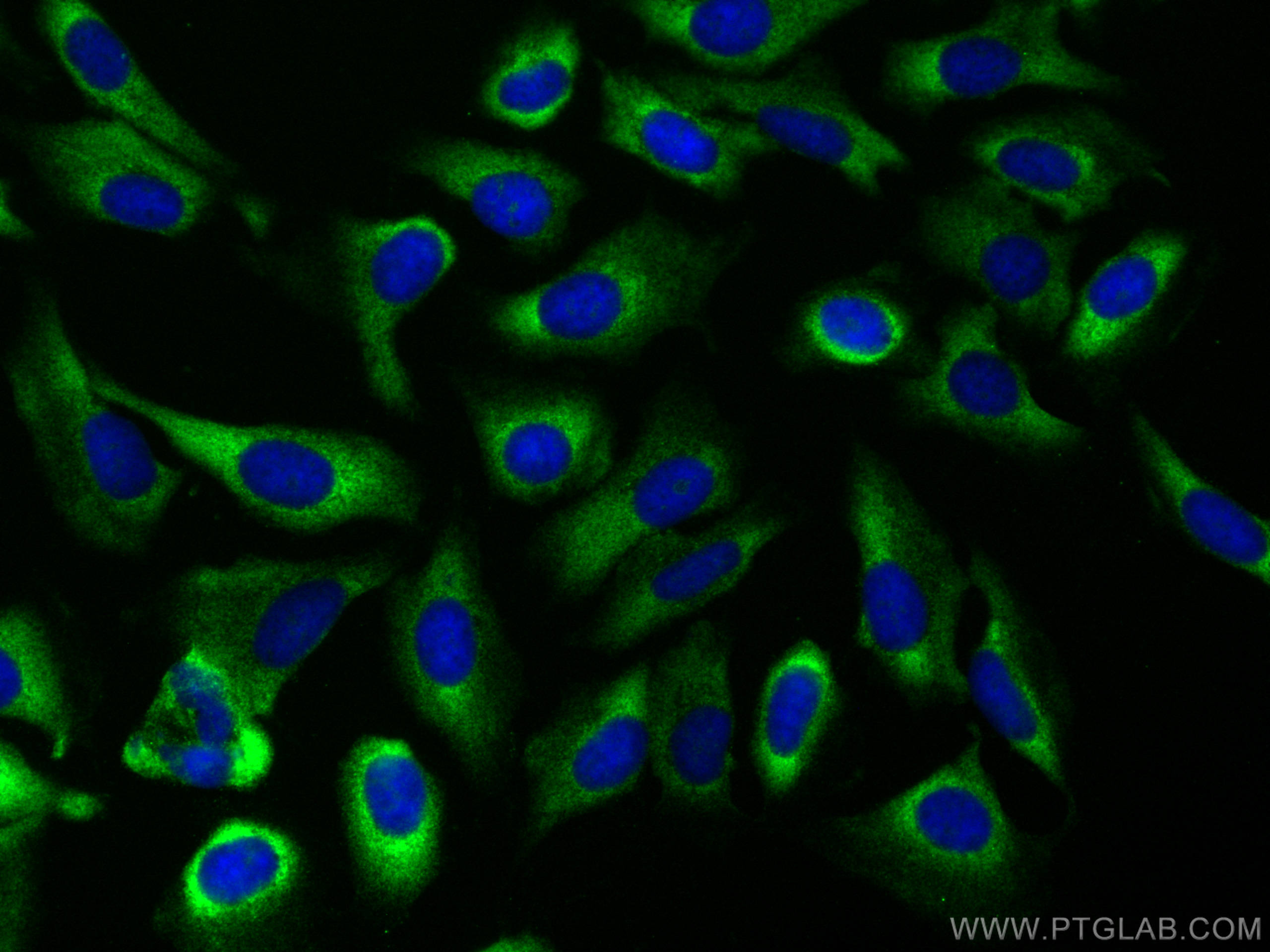 IF Staining of U2OS using 82512-1-RR