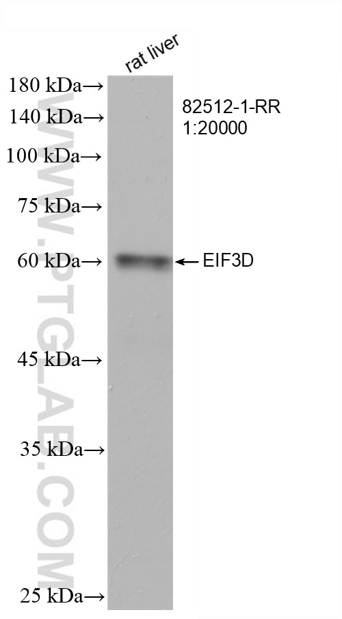 Western Blot (WB) analysis of rat liver tissue using EIF3D Recombinant antibody (82512-1-RR)