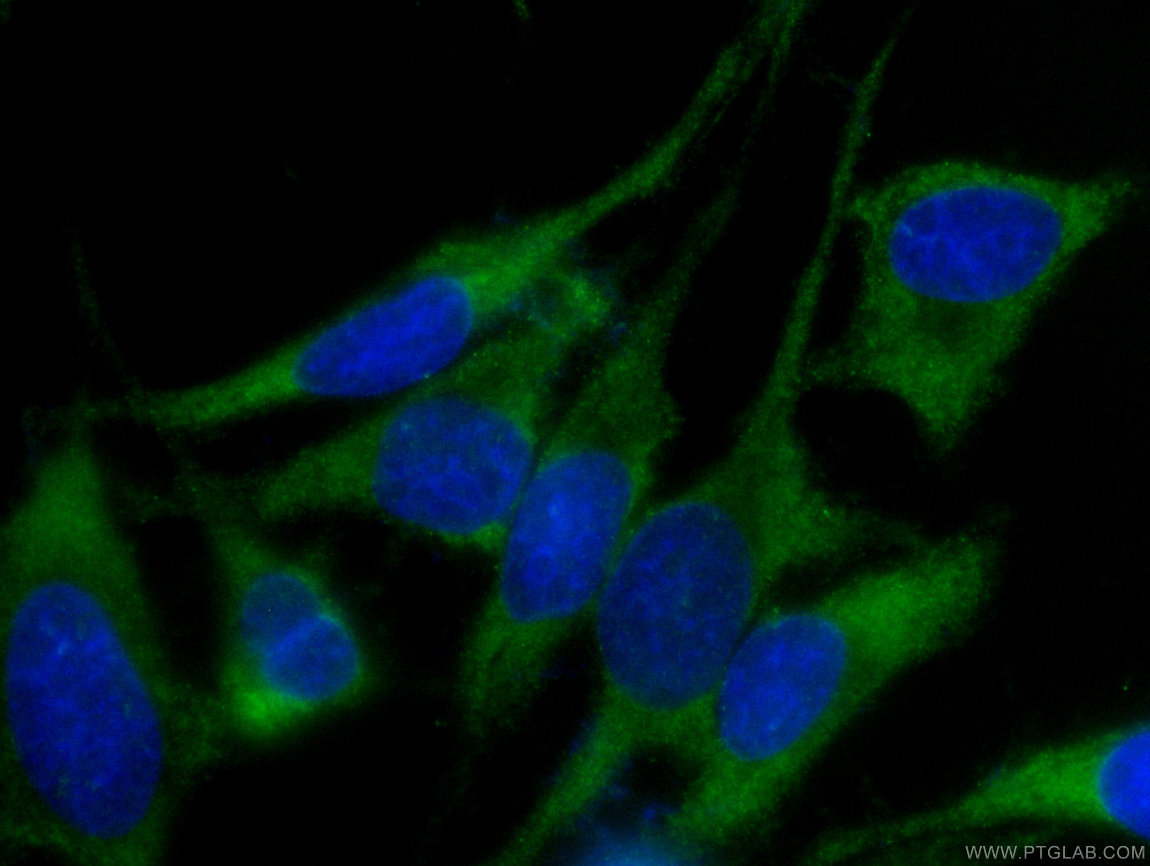 Immunofluorescence (IF) / fluorescent staining of HeLa cells using CoraLite® Plus 488-conjugated EIF3D Monoclonal ant (CL488-66024)
